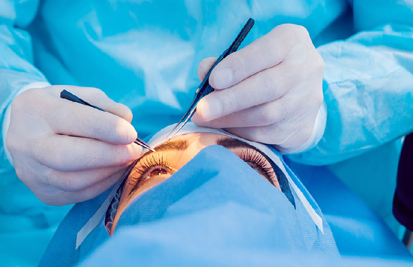 Glaucoma Surgery